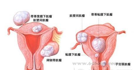 女性拒绝包皮过长男!不信进来看!